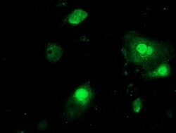 PNMT Mouse anti-Human, Clone: OTI2A2, lyophilized, TrueMAB 100 &mu;g; Unconjugated:Antibodies,