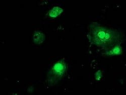 PNMT Monoclonal Antibody (OTI2A2), TrueMAB , OriGene 30 &mu;L; Unconjugated:Antibodies,
