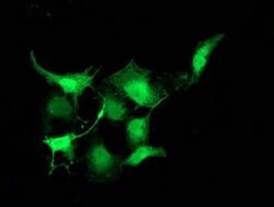 PNMT Monoclonal Antibody (OTI2E3), TrueMAB , OriGene 30 &mu;L; Unconjugated:Antibodies,
