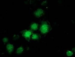 PNMT Monoclonal Antibody (OTI2A3), TrueMAB , OriGene 30 &mu;L; Unconjugated:Antibodies,