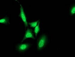 PNMT Monoclonal Antibody (OTI2A3), TrueMAB , OriGene 30 &mu;L; Unconjugated:Antibodies,