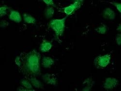 PNMT Monoclonal Antibody (OTI2H6), TrueMAB , OriGene 30 &mu;L; Unconjugated:Antibodies,