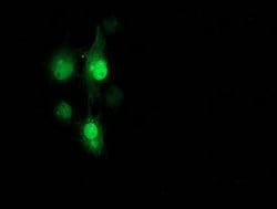 PNMT Mouse anti-Human, Clone: OTI1B7, lyophilized, TrueMAB 100 &mu;g; Unconjugated:Antibodies,