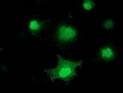 PNMT Monoclonal Antibody (OTI1D5), TrueMAB , OriGene 100 &mu;L; Unconjugated:Antibodies,