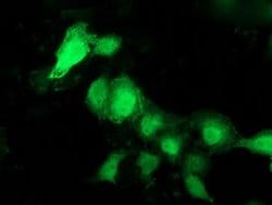 PNMT Monoclonal Antibody (OTI1B11), TrueMAB , OriGene:Antibodies:Primary