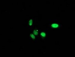 PNMT Monoclonal Antibody (OTI1B11), TrueMAB , OriGene 100 &mu;L; Unconjugated:Antibodies,