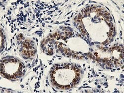 PNMT Monoclonal Antibody (OTI2F3), TrueMAB , OriGene 100 &mu;L; Unconjugated:Antibodies,