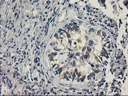 PNMT Monoclonal Antibody (OTI2E3), TrueMAB , OriGene 30 &mu;L; Unconjugated:Antibodies,