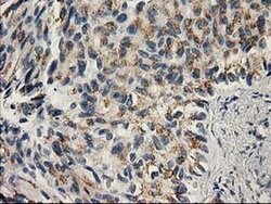 PNMT Monoclonal Antibody (OTI1B11), TrueMAB , OriGene:Antibodies:Primary