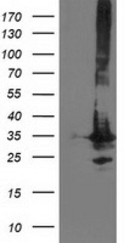 PNMT Mouse anti-Human, Clone: OTI2A2, lyophilized, TrueMAB 100 &mu;g; Unconjugated:Antibodies,