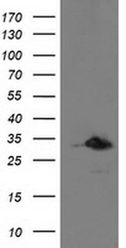 PNMT Monoclonal Antibody (OTI2E3), TrueMAB , OriGene 30 &mu;L; Unconjugated:Antibodies,