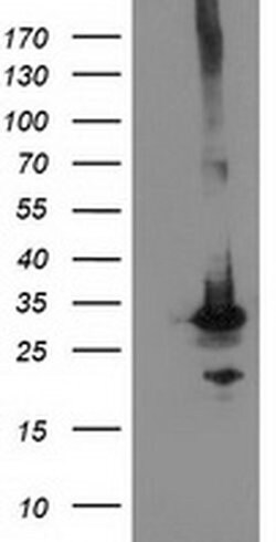PNMT Monoclonal Antibody (OTI2G4), TrueMAB , OriGene 100 &mu;L; Unconjugated:Antibodies,