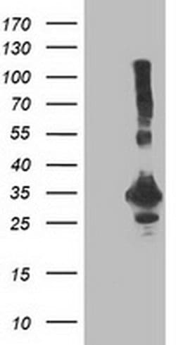 PNMT Monoclonal Antibody (OTI2A3), TrueMAB , OriGene:Antibodies:Primary