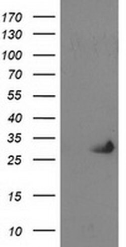 PNMT Monoclonal Antibody (OTI1D5), TrueMAB , OriGene 100 &mu;L; Unconjugated:Antibodies,