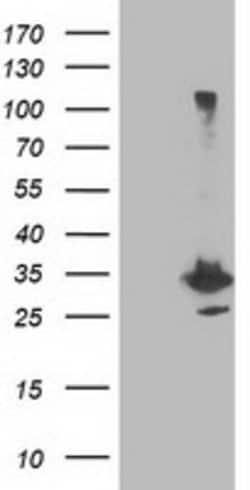PNMT Mouse anti-Human, Clone: OTI1F3, lyophilized, TrueMAB 100 &mu;g; Unconjugated:Antibodies,