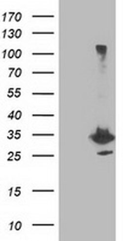 PNMT Monoclonal Antibody (OTI1F3), TrueMAB , OriGene 30 &mu;L | Buy Online | Origene Technologies | Fisher Scientific