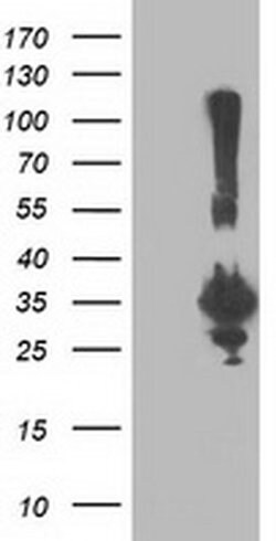 PNMT Monoclonal Antibody (OTI1F1), TrueMAB , OriGene 100 &mu;L; Unconjugated:Antibodies,
