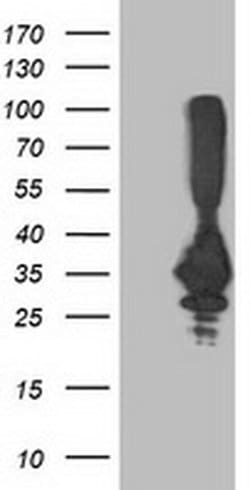 PNMT Monoclonal Antibody (OTI1B11), TrueMAB , OriGene 100 &mu;L; Unconjugated:Antibodies,
