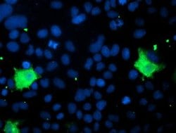 PNPO Monoclonal Antibody (OTI3B3), TrueMAB , OriGene 100 &mu;L; Unconjugated:Antibodies,