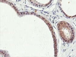 PNPO Monoclonal Antibody (OTI1H9), TrueMAB , OriGene 100 &mu;L; Unconjugated:Antibodies,