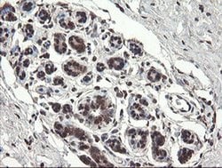 PNPO Monoclonal Antibody (OTI1G9), TrueMAB , OriGene 100 &mu;L; Unconjugated:Antibodies,
