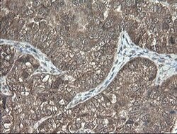 PNPO Monoclonal Antibody (OTI1G9), TrueMAB , OriGene 100 &mu;L; Unconjugated:Antibodies,