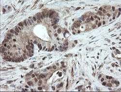 PNPO Monoclonal Antibody (OTI1G9), TrueMAB , OriGene 100 &mu;L; Unconjugated:Antibodies,