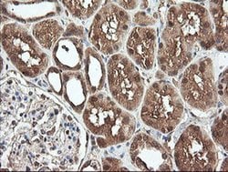 PNPO Monoclonal Antibody (OTI1G9), TrueMAB , OriGene 100 &mu;L; Unconjugated:Antibodies,