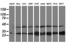 PNPO Monoclonal Antibody (OTI3B3), TrueMAB , OriGene 100 &mu;L; Unconjugated:Antibodies,