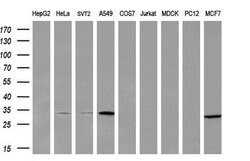 PNPO Monoclonal Antibody (OTI1H9), TrueMAB , OriGene 100 &mu;L; Unconjugated:Antibodies,