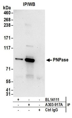 PNPase Rabbit anti-Human, Polyclonal, Bethyl Laboratories 100 &mu;L; Unconjugated:Antibodies,