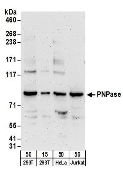 PNPase Rabbit anti-Human, Polyclonal, Bethyl Laboratories 100 &mu;L; Unconjugated:Antibodies,