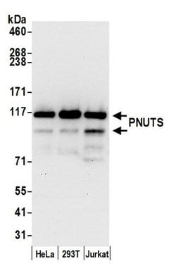 PNUTS Polyclonal Antibody, Bethyl Laboratories 20 &mu;L; Unconjugated:Antibodies,