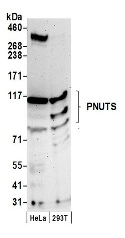 PNUTS Rabbit anti-Human, Polyclonal, Bethyl Laboratories 100 &mu;L; Unconjugated:Antibodies,