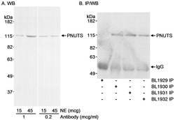 PNUTS Rabbit anti-Human, Polyclonal, Bethyl Laboratories 100 &mu;L; Unconjugated:Antibodies,