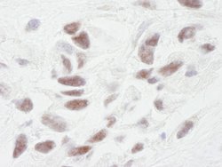 PNUTS Polyclonal Antibody, Bethyl Laboratories 10 &mu;L | Buy Online | Bethyl Laboratories, Inc | Fisher Scientific