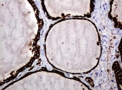 POGK Monoclonal Antibody (OTI6D5), TrueMAB , OriGene 100 &mu;L; Unconjugated:Antibodies,