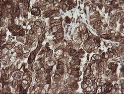 POGK Monoclonal Antibody (OTI2G8), TrueMAB , OriGene:Antibodies:Primary
