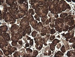 POGK Monoclonal Antibody (OTI2G8), TrueMAB , OriGene 100 &mu;L; Unconjugated:Antibodies,