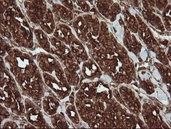 POGK Monoclonal Antibody (OTI2G8), TrueMAB , OriGene 100 &mu;L; Unconjugated:Antibodies,