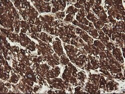 POGK Monoclonal Antibody (OTI2G8), TrueMAB , OriGene:Antibodies:Primary