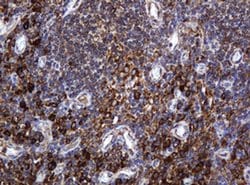 POGK Monoclonal Antibody (OTI3D2), TrueMAB , OriGene 100 &mu;L; Unconjugated:Antibodies,