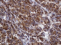 POGK Mouse anti-Human, Clone: OTI3D2, lyophilized, TrueMAB 100 &mu;g; Unconjugated:Antibodies,