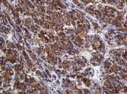 POGK Monoclonal Antibody (OTI3D2), TrueMAB , OriGene 100 &mu;L; Unconjugated:Antibodies,