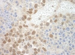 POGZ Polyclonal Antibody, Bethyl Laboratories 10 &mu;L; Unconjugated:Antibodies,