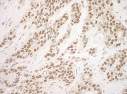 POGZ Polyclonal Antibody, Bethyl Laboratories 10 &mu;L; Unconjugated:Antibodies,