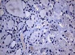 POLI Mouse anti-Human, Clone: OTI1C8, lyophilized, TrueMAB 100 &mu;g; Unconjugated:Antibodies,
