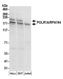 POLR1A/RPA194 Polyclonal Antibody, Bethyl Laboratories 20 &mu;L; Unconjugated:Antibodies,