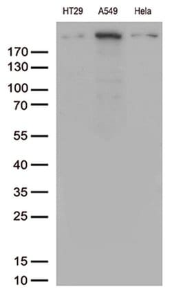 POLR2A Monoclonal Antibody (OTI1E5), TrueMAB , OriGene 100 &mu;L; Unconjugated:Antibodies,