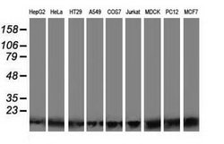 POLR2J2 Mouse anti-Human, Clone: OTI8F10, lyophilized, TrueMAB 100 &mu;g;